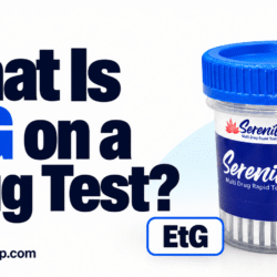 what is an etg test